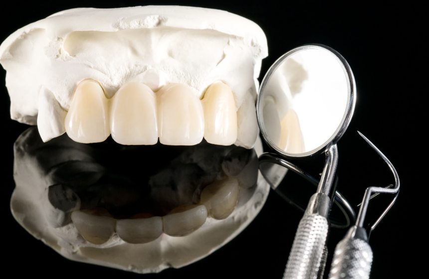 Ceramic Dental bridge