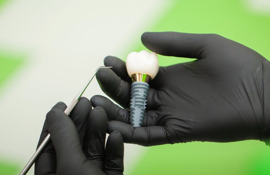 Plastic Dental implant model